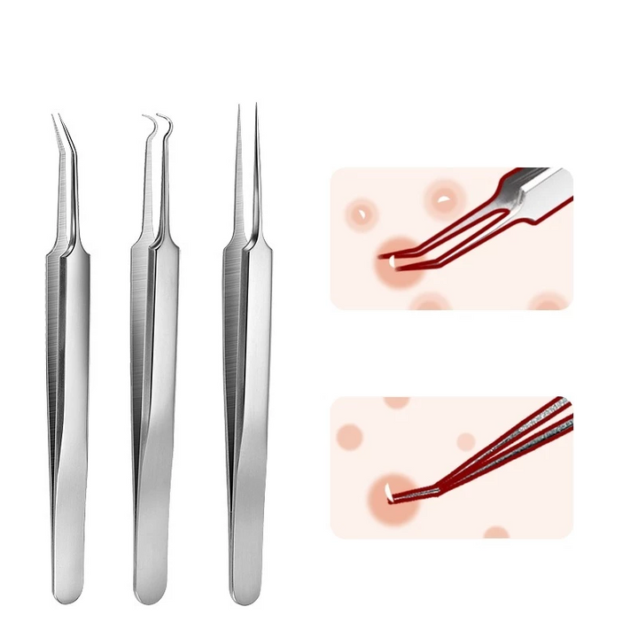 Bộ dụng cụ chăm sóc da & lấy mụn 6 chi tiết tiện lợi